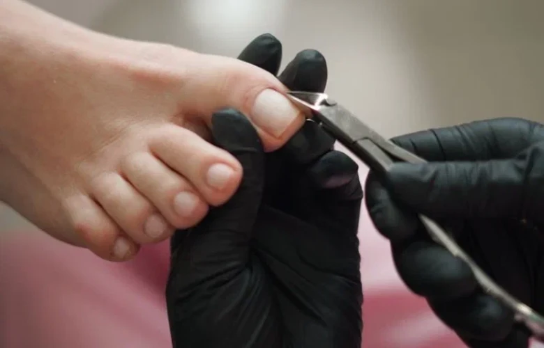 Что такое медицинский педикюр?