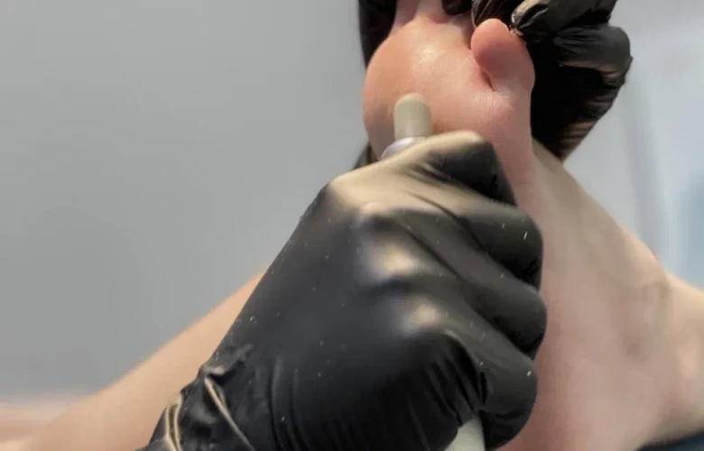 Почему трескаются пятки: причины и лечение