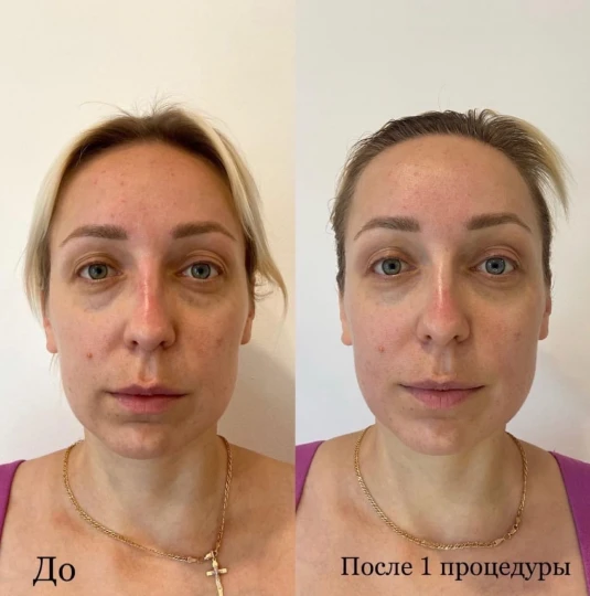 Массаж лица + альгинатная маска. Фото 1